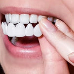 IMPORTED Snap-On Teeth Veneers
