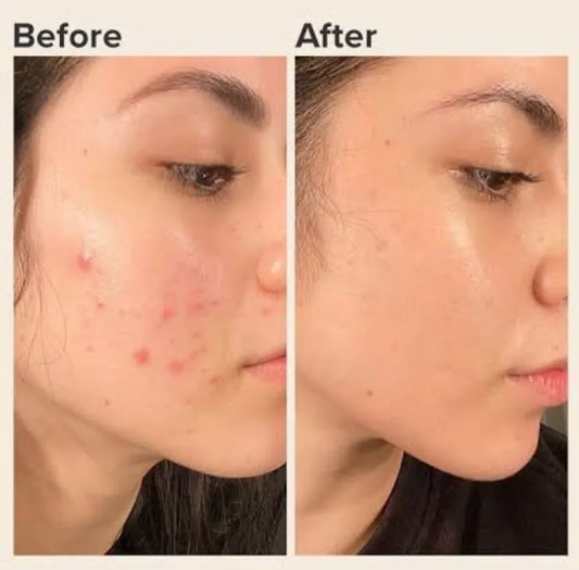 Zafarani Whitening Gold Cream