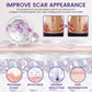 TiMilk - ReGen Scar Stem Cell Repair Gel (Imported)