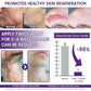 TiMilk - ReGen Scar Stem Cell Repair Gel (Imported)